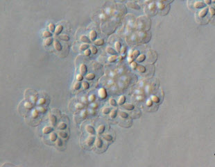 写真1　K.septempunctata胞子（提供：国立感染症研究所寄生動物部主任研究官の八木田健司氏）