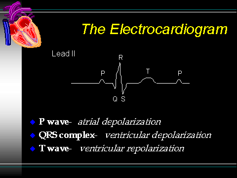 EKG2.gif