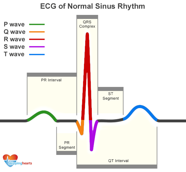 ecg_normal_sinus_rhythm.gif